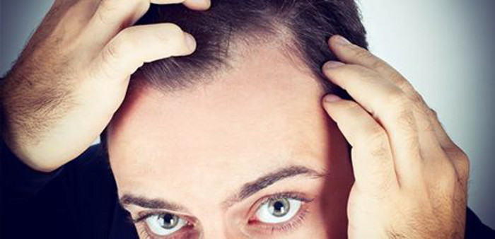 PRP Platelet Rich Plasma hair loss