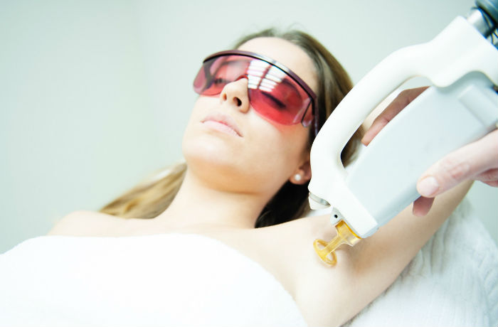 Laser hair removal