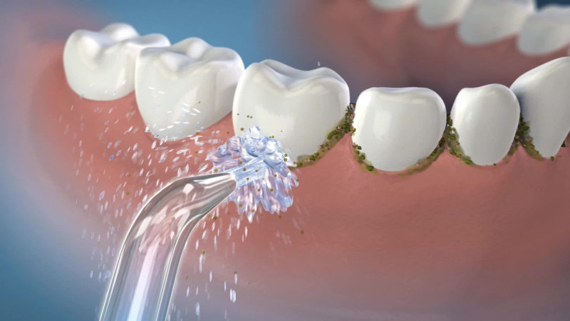 Waterpik 450 Cordless Plus Water Flosser