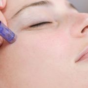 microneedling