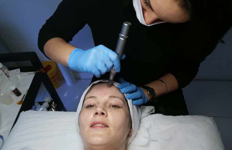 Pulse Microneedling