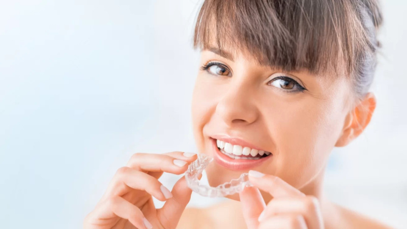 Active Aligners