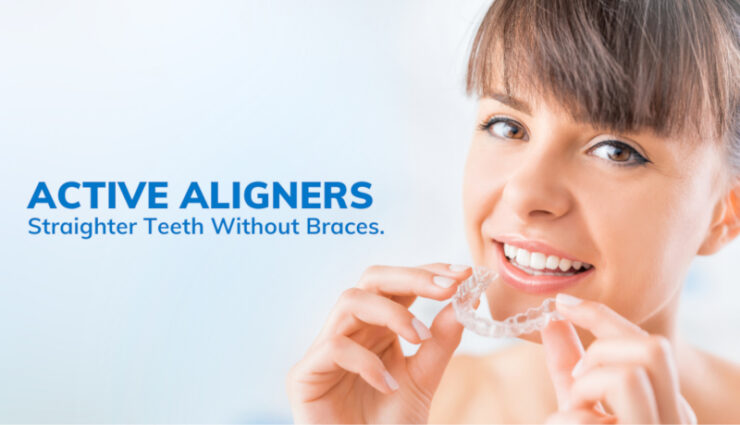 Active Aligners Review: Cost, Benefits & Results of Clear Aligners in ...