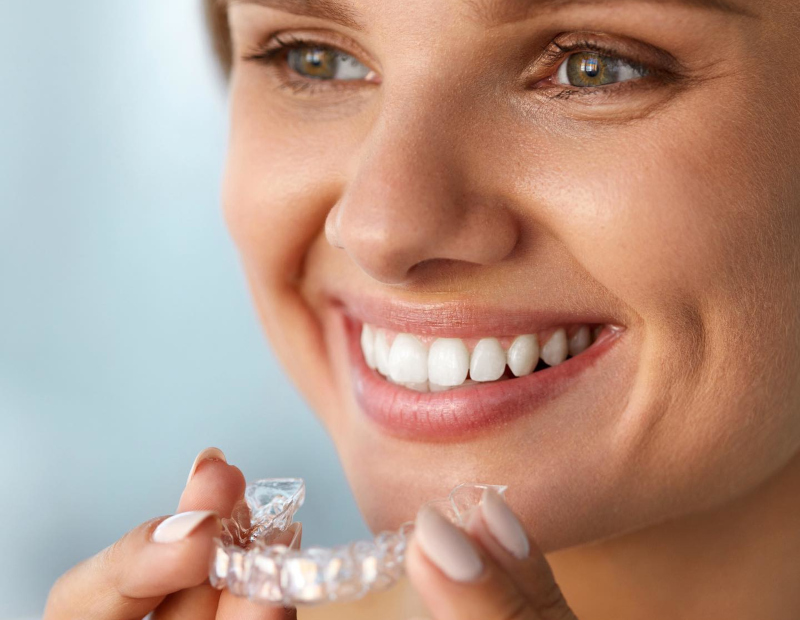 Active Aligners