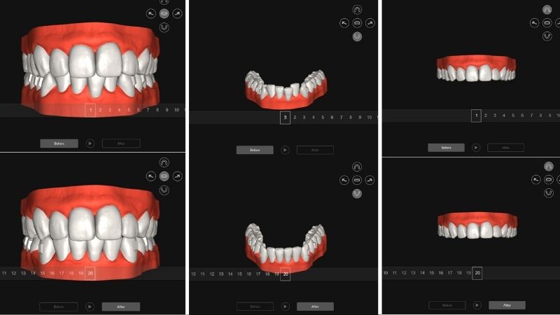 3D scan Active Aligner