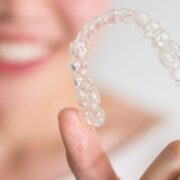Active Aligners