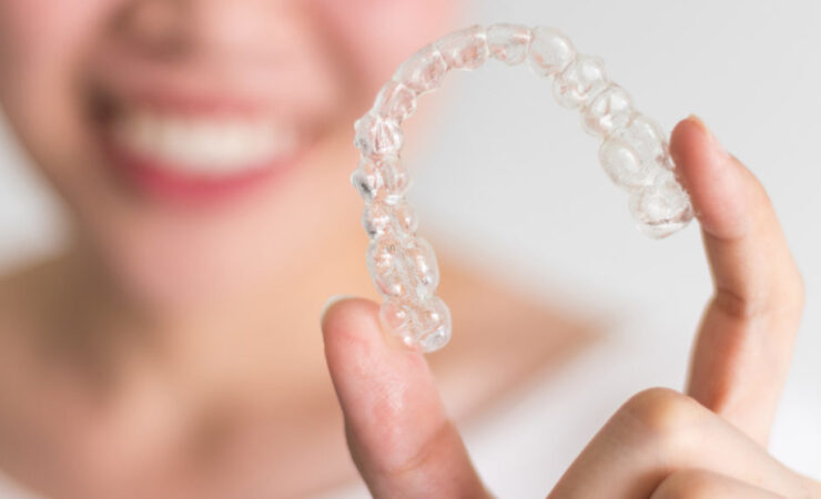 Active Aligners