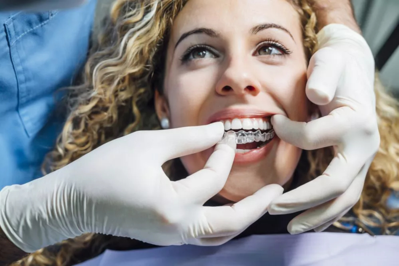 Active Aligners clear aligners review