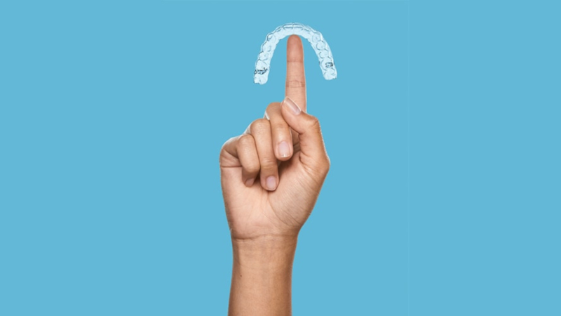 Active Aligners clear aligners review
